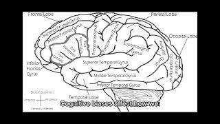 What is Cognitive Bias? (Explained Simply)