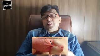 frenulum tear | short frenulum | frenulum breve लिंग की टाइट सील क्या होती है