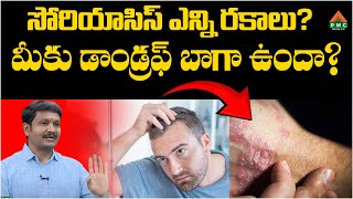 సోరియాసిస్ ఎన్ని రకాలు?   | PMC Health