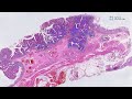 Stroma Analyzer - perform an automated analysis of tumour stroma content using H&E stained sections