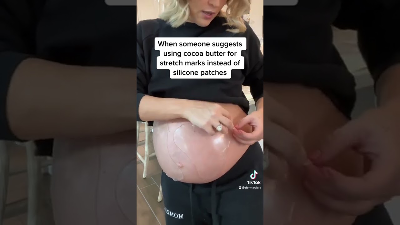 Most creams don’t reach the layer of the dermis where stretch marks are formed #stretchmarks