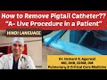 How to Remove Pigtail Catheter? “A- Live Procedure in a Patient” (HINDI) @Dr. Hemant Kumar Agarwal