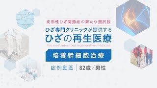 変形性ひざ関節症治療【症例動画】82歳/男性