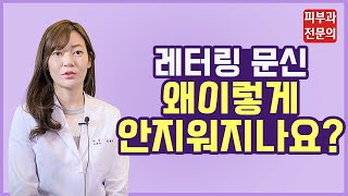 문신제거 잘 안 빠지는 이유 공개합니다! 레이저 문신제거 반전 실체 | 타투제거, 문신제거레이저, 후회하는 타투지우기