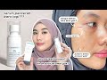 2 Minggu Pakai Skintific 3% Tranexamic Acid - Bagus kah???