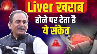 लिवर खराब होने के शुरुआती लक्षण | Liver Disease Symptoms | Acharya Manish ji | Hiims