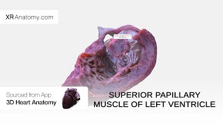 Superior papillary muscle of left ventricle