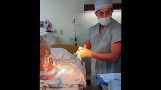 Continuous labor epidural in the hospital setting. Full video on a real patient.