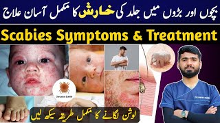 Scabies Home Treatment | Symptoms | Kharish Ka ilaaj | Dr Shaban Akbar جلدکی خارش کی علامات اور علاج