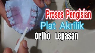 Proses pengisian plat orthodonti Lepasan