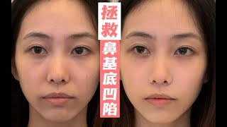 【干货】拯救鼻基底凹陷｜解决法令纹卡粉｜手把手教学！追求自然不假面的质感