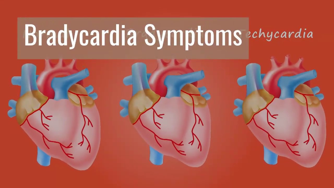 Bradycardia Symptoms - What Is Bradycardia - Bradycardia Treatment ...