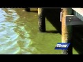 St. Lucie River causing health hazard