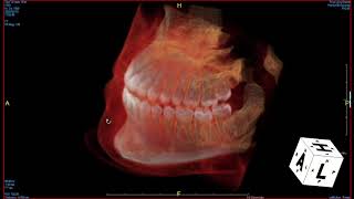 CBCT Demo 7min