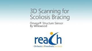 3D Scanning for Scoliosis Bracing