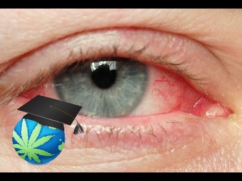 How To Get Rid of Red Eyes & High FASTER How To Get Rid of Red Eyes & High FASTER