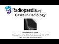 Osteomyelitis of elbow (Radiopaedia.org) Cases in Radiology