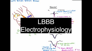 Left Bundle Branch Block Electrophysiology