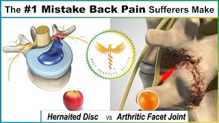 The #1 Mistake Most People Suffering from Back Pain Make