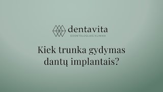 Kiek laiko trunka gydymas dantų implantais?