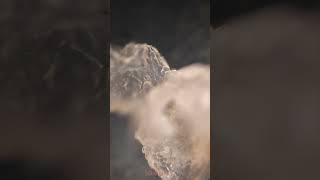 Dandruff under microscope. #shorts #microfact