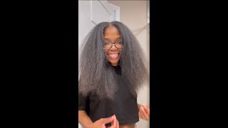 My Postpartum Hair Loss and Hair Regrowth Journey #shorts | SoDazzling