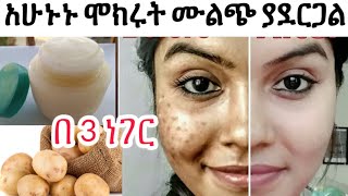 ማድያት እና ጥቋቁር ነገር ካለባችሁ አሁኑን ይቀቡ ፅድት ያደርጋል አስተማማኝ የፊት ክሬም በዶክተሮች የተረጋገጠ potato face mask skincare