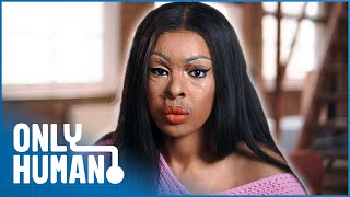 The Acid Attack That Changed My Life | Investigative Documentary