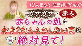 ガサガサ・赤み　赤ちゃんの肌を今すぐなんとかしたい方は絶対見て！