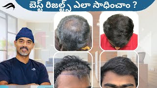 Hair Transplant In Vizag | Best Clinic Surgeon Center \u0026 Results Of Hair Transplant In Vizag