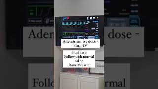 Supraventricular Tachycardia - ECG interpretation,