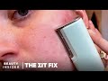 $200 Dermaplaning Device Claims To Remove Flaky Skin And Peach Fuzz | The Zit Fix