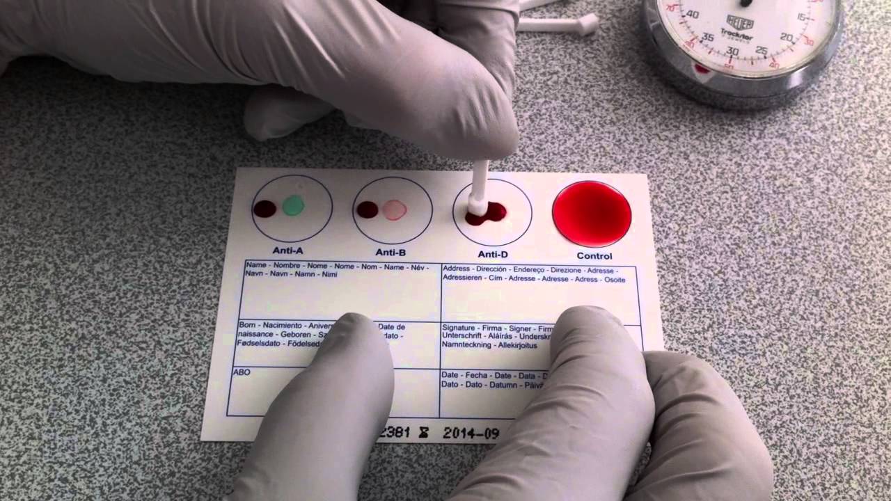 Blood Typing Using EldonCard (HD) - YouTube