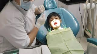 treatment for tooth decay|prevent tooth cavity|#subscribe #viral #like #trending#dentist #cavity