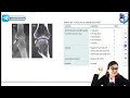 rapid revision internal medicine rheumatology dr aishwarya for neet pg