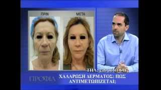 Γ.ΣΚΟΥΡΑΣ-ΧΑΛΑΡΩΣΗ ΔΕΡΜΑΤΟΣ 1ο ΜΕΡΟΣ