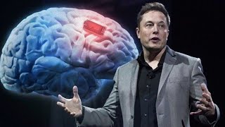 What Exactly Elon Musk's Neuralink Company Does?