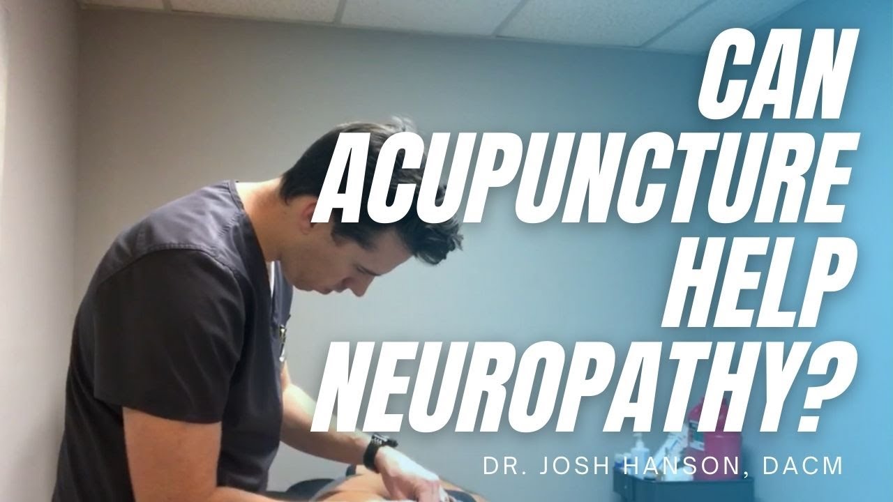 Can Acupuncture Help Neuropathy? - YouTube