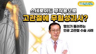 스테로이드 부작용으로 고관절에 무혈성괴사?(명의 인공고관절 사례)