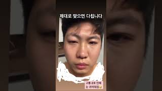 제대로 맞으면 (feat20온스 헤드기어)