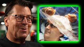 The Wild Reason Brain Surgery Is Done While You’re Awake | Dr. Brian Hoeflinger