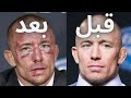 شاهد قصة النزال الذي غيّر ملامح الأسطورة جورج سانت بيير وجعله يفقد الذاكرة ودفعه إلى الإعتزال