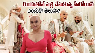 గుండుతోనే పెళ్లి | Neehar Sachdeva Married with Blad Head Goes Viral | Cinema Kaburlu