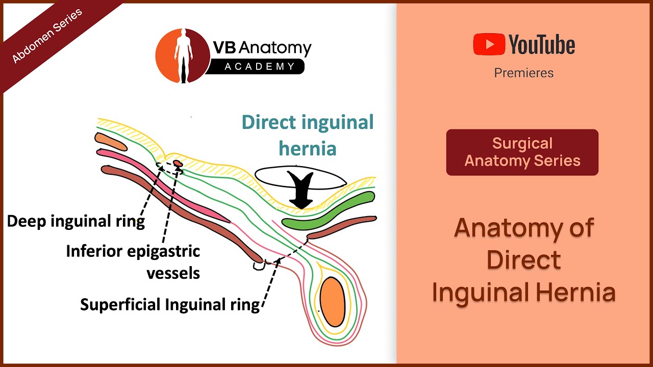 Inguinal Hernia Surgical Anatomy Inguinal Hernia Charleston Gi
