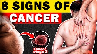 8 EYE-OPENING Warning Sign Is CANCER Silently Sneaking Up on You?