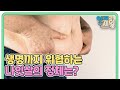 나이 먹는 것도 서러운데 살도 찐다? 방치하면 생명까지 위협하는 나잇살의 정체는? MBN 230725 방송