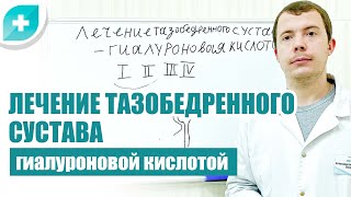 Лечение тазобедренного сустава гиалуроновой кислотой