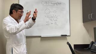 Optic nerve hypoplasia