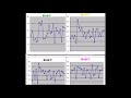 ロト７予想492回 10 14 __chance3億円