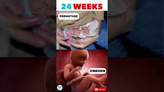 Watch the Miracle of a 24 weeks baby ❤️🥰 Premature birth | 24 week fetus #shortsvideo #shorts